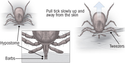 tick
